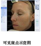 VISIA�沿�D������x�a(ch��n)Ʒ��B