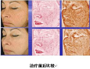 VISIA�沿�D������x�a(ch��n)Ʒ��B