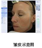 VISIA�沿�D������x�a(ch��n)Ʒ��B