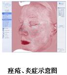 VISIA�沿�D������x�a(ch��n)Ʒ��B