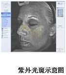 VISIA�沿�D������x�a(ch��n)Ʒ��B