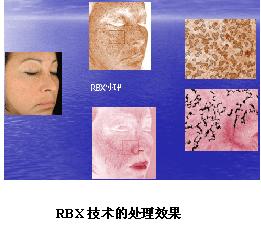 VISIA�沿�D������x�a(ch��n)Ʒ��B